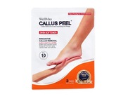 CALLUS PEEL Súprava kyslej pedikúry, 2 ks