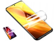 REALME 7 PRO ESTIPRO HYDROGELOVÁ OCHRANNÁ FÓLIA REALME 7 PRO ESTIPRO HYDROGELOVÁ OCHRANNÁ FÓLIA