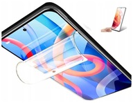 HYDROGELOVÁ FÓLIA Xiaomi Mi 11 LITE 5g NE RESISTANT Hybrid pre TEL Screen HYDROGELOVÁ FÓLIA Xiaomi Mi 11 LITE 5g NE RESISTANT Hybrid pre TEL Screen