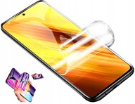 XIAOMI 12X 5G SOLID Hybridná hydrogélová ochranná fólia na obrazovku TEL XIAOMI 12X 5G SOLID Hybridná hydrogélová ochranná fólia na obrazovku TEL