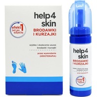 Help4skin bradavice a bradavice 50 ml Help4skin bradavice a bradavice 50 ml