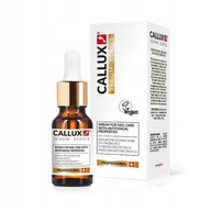 Callux antimykotické sérum na nechty 10ml Callux antimykotické sérum na nechty 10ml