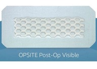 Smith Nephew OPSITE POST-OP VIDIBLE 35x10cm 1 ks, Smith Nephew OPSITE POST-OP VIDIBLE 35x10cm 1 ks,
