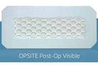 Smith Nephew OPSITE POST-OP VIDIBLE 35x10cm 1 ks,