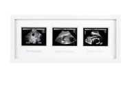 Pearhead Frame pre 3 ultrazvukové fotografie Biela