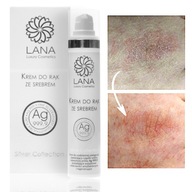 Ag+ Efektívny KRÉM na ruky s NANO SILVER UREA Ag+ Efektívny KRÉM na ruky s NANO SILVER UREA