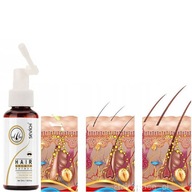 Sprej 50ml zázvor vypadávanie vlasov, plešatosť, rast vlasov Sprej 50ml zázvor vypadávanie vlasov, plešatosť, rast vlasov